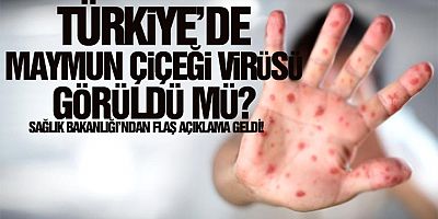 Maymun Çiçeği virüsü Türkiye'de görüldü mü?