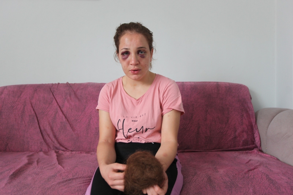 3 çocuk annesi Özlem’i bu hale kocası getirdi