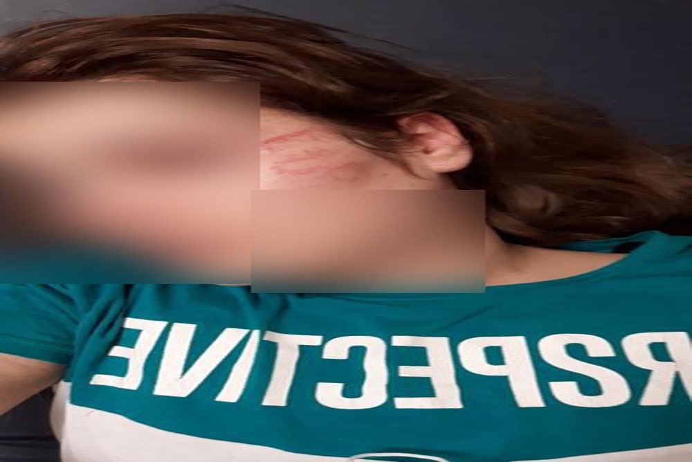 Ağabeyinin darp ettiği üniversiteli Ceylan, kendini ikinci kattan attı