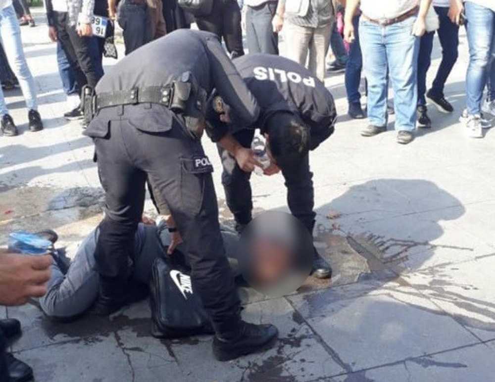 ATM gaspçısı, polise kafa atıp dudağını patlattı