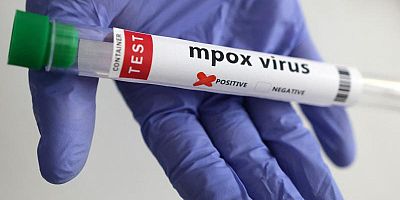 Avrupa'da maymun çiçeği virüsü uyarısı:Risk düşük ancak hazırlıklı olunmalı
