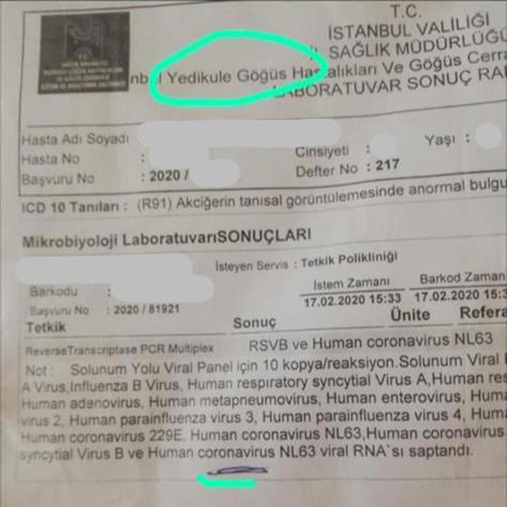 Bakan Koca: “Yedikule Hastanesi’nde konulan tanı Yeni Koronavirüs değil”