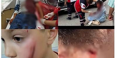 Başıboş köpek sorunu öyle bir noktaya geldi ki.. Son rakamlar şoke etti!