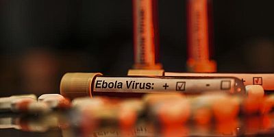 BM: KDC'de etkili olan Ebola salgını 1 milyon kişiyi daha yoksulluğa itecek