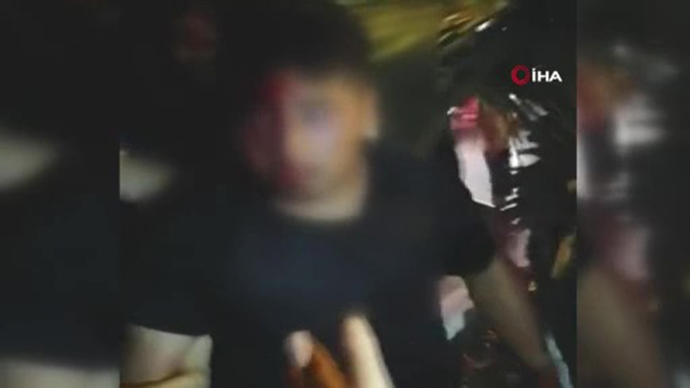 Çakmağı çaktı, dayağı yedi