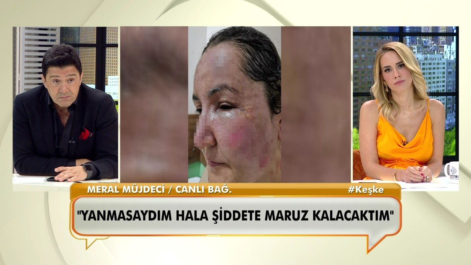 Canlı yayında bağlanan kadın, eşinin kendisini kızgın yağ ile yaktığını söyledi
