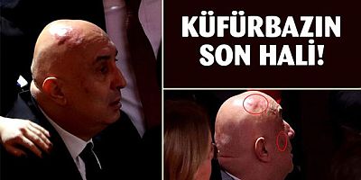 CHP'li Engin Özkoç'un dayaktan sonraki son hali