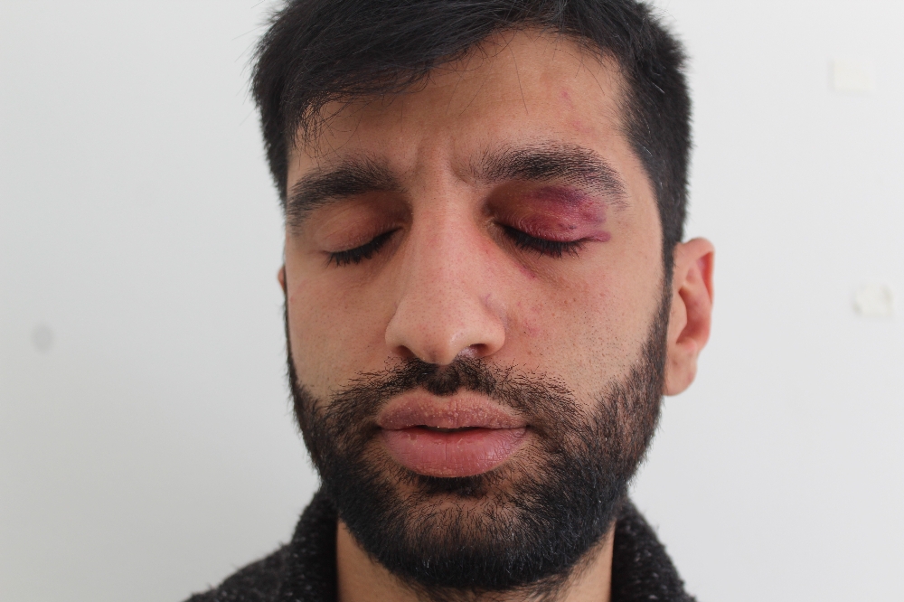 CHP’de kavga şoku