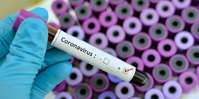 Çin koronavirüsü iyileştiren ilacı resmen duyurdu