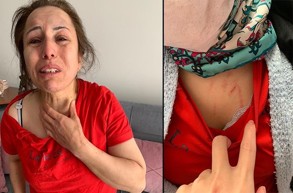 Dehşeti yaşayan kadından kocasına yardım eden zanlı hakkında suç duyurusu