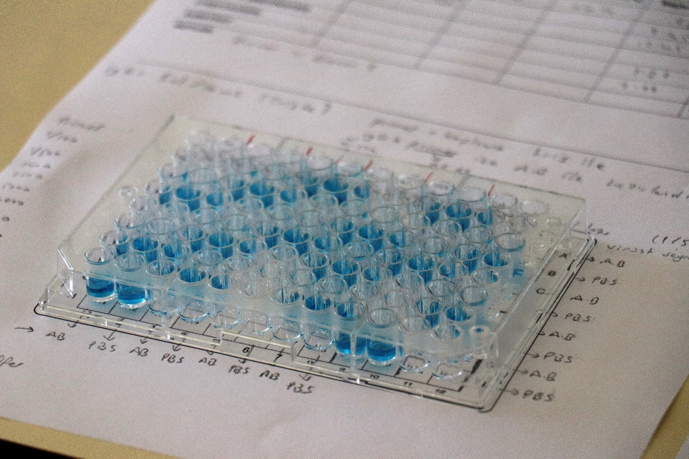 ELISA testi ile hem koronavirus hem de antikorları daha çabuk tespit edilebilecek