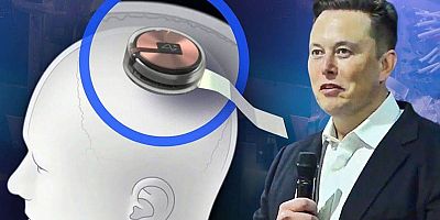 Elon Musk'tan bomba çıkış:Beyne çip takmak, Metaverse'ten daha iyi