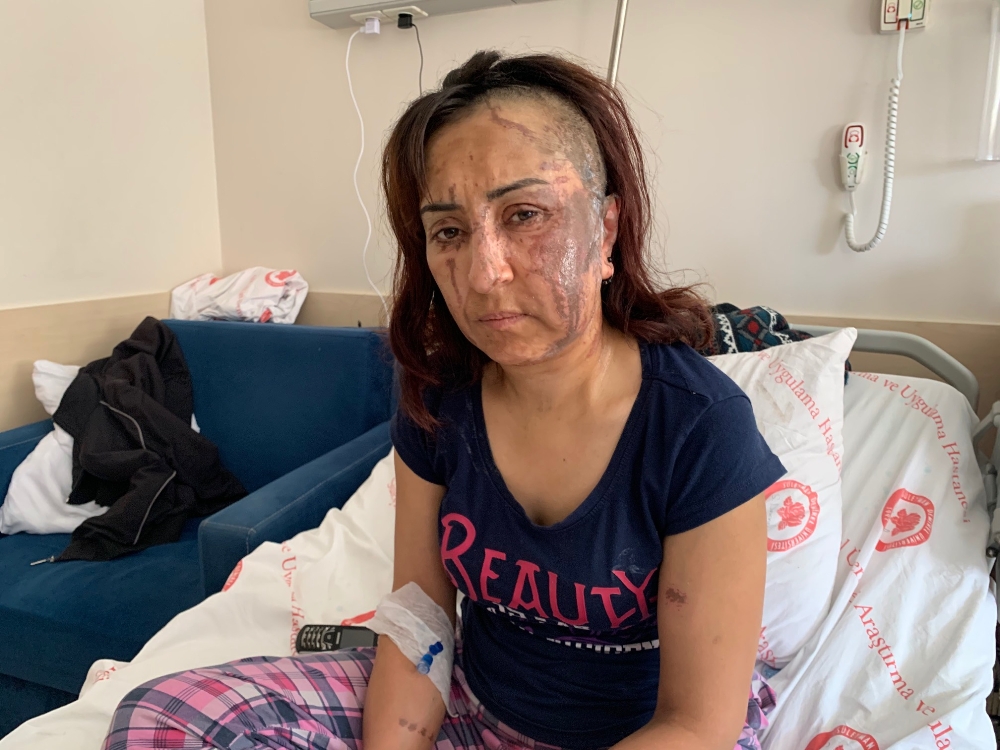 Eşine kezzapla saldıran koca tutuklandı
