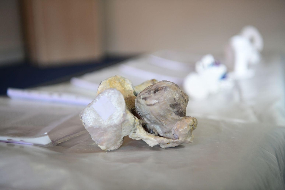 EÜ’de ortopedik tedavide yeni bir model geliştirildi