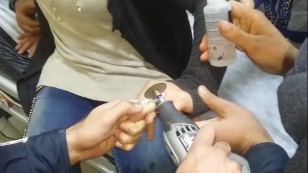 Genç Kadının Parmağına Sıkışan Yüzük Kesilerek Çıkarıldı