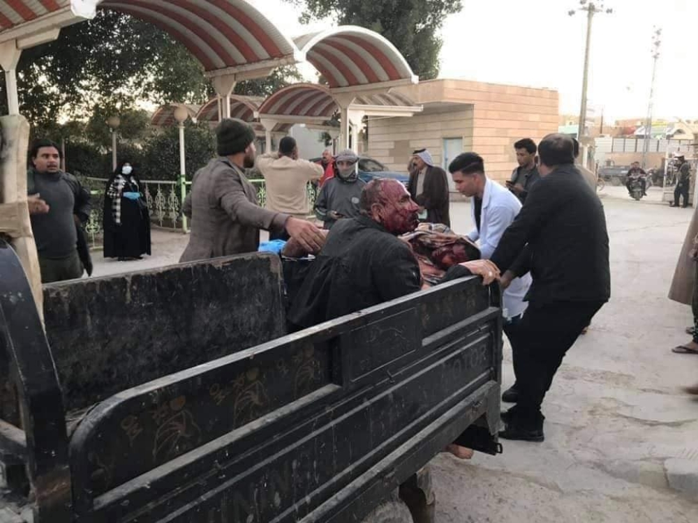 Irak’ta fırında patlama: 20’den fazla yaralı