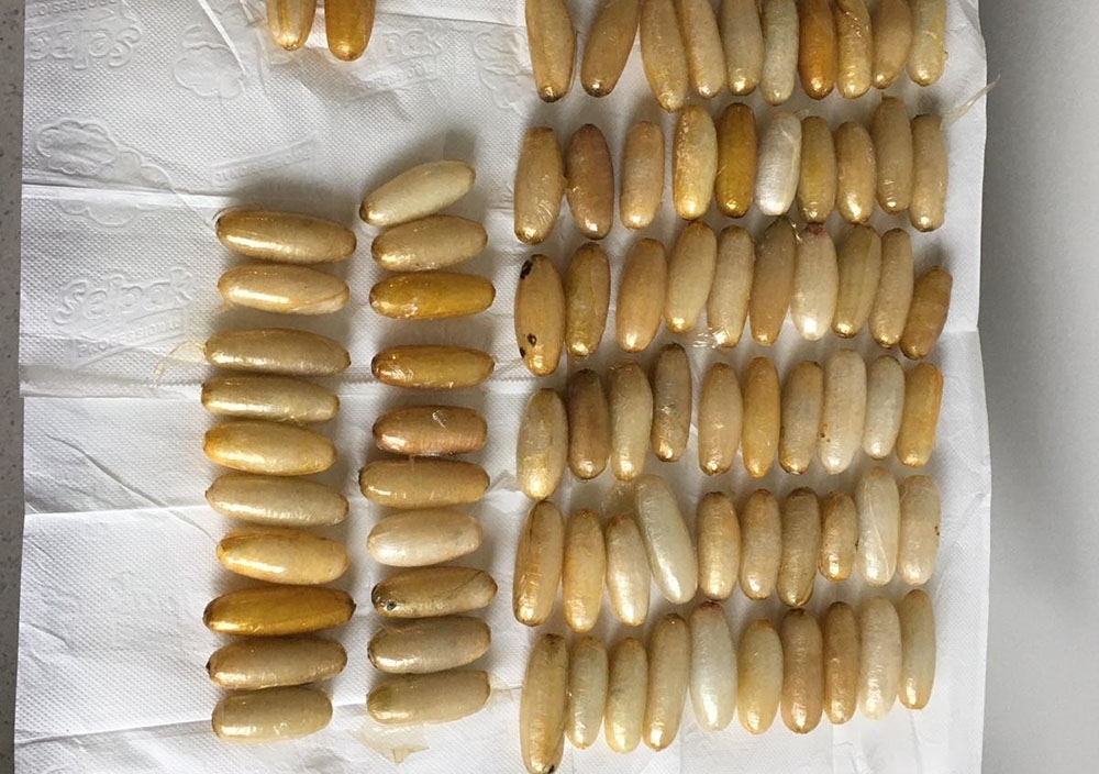 İstanbul Havalimanı’nda yolcunun midesinden 93 kapsül uyuşturucu çıktı