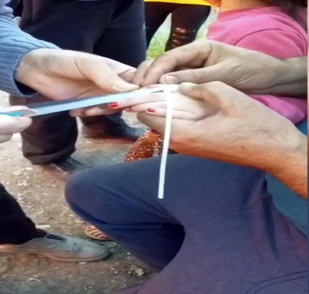 İstanbul’da parmağını sıkıştıran küçük kıza maket bıçaklı müdahale