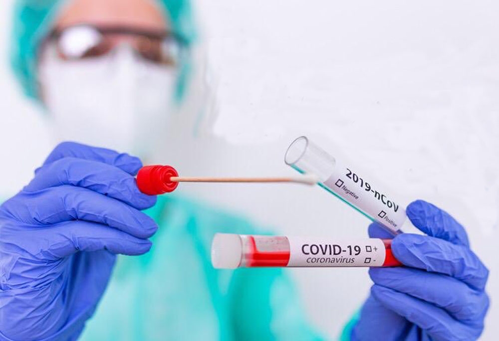 Japonya’da 3 ay sonra bir ilk: Günlük Covid-19 vaka sayısı bin 500’ü aştı