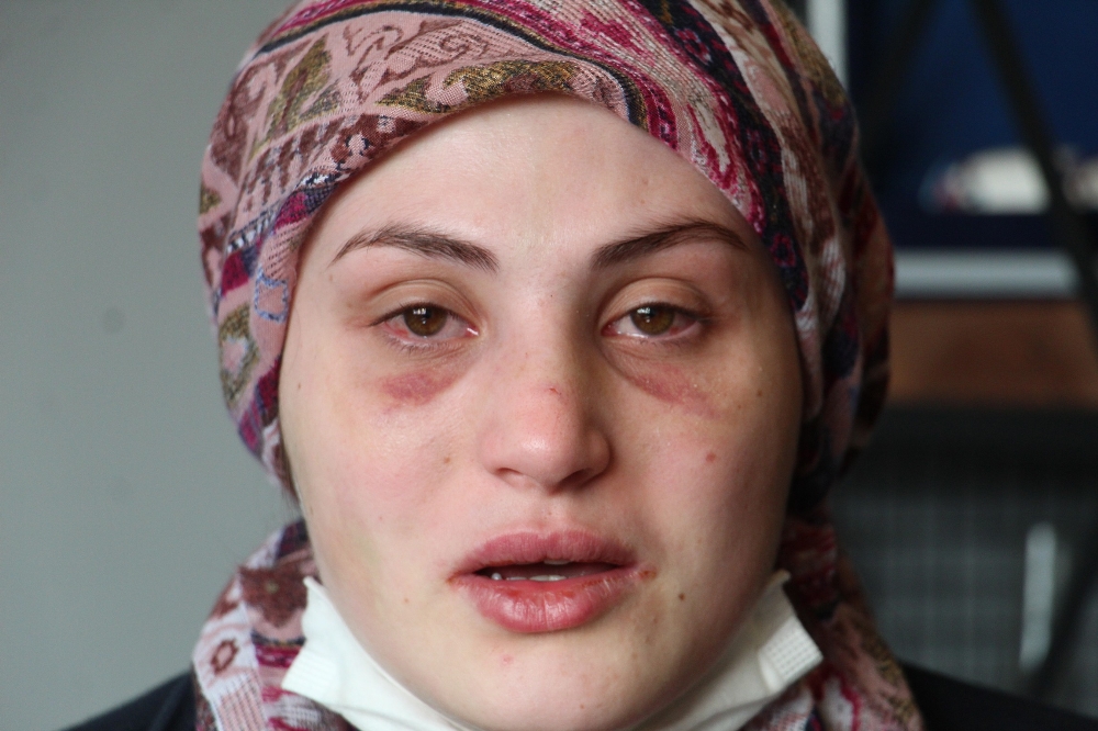 Kaçarak evlendiği eşi, genç kadına kabusu yaşattı