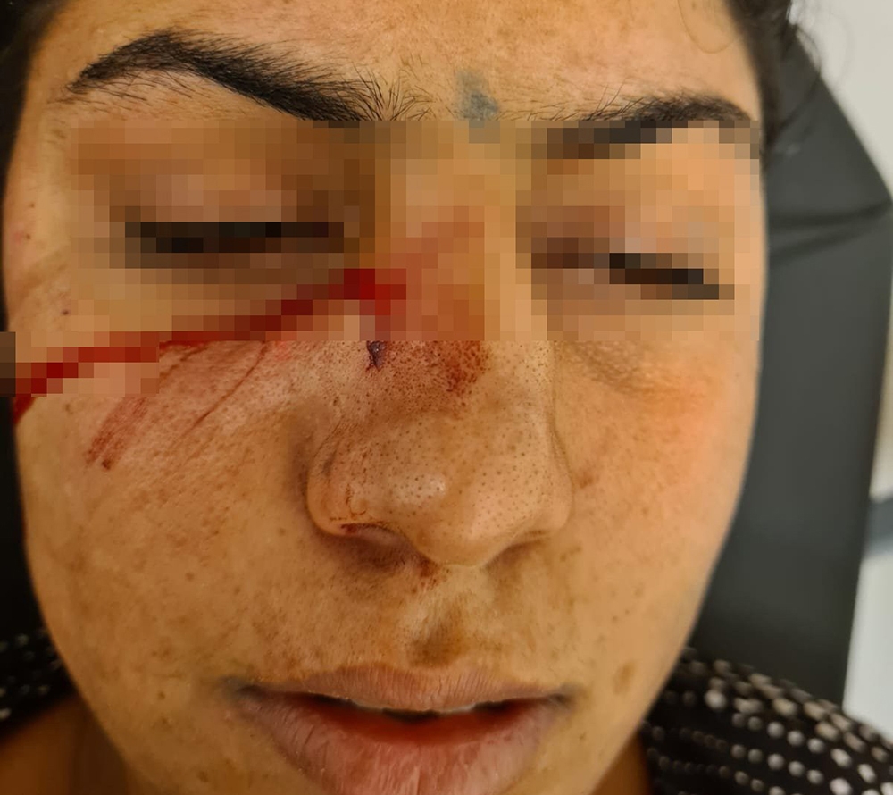 Kahvaltı hazırlamayan eşine kafa atıp burnundan bıçakladı