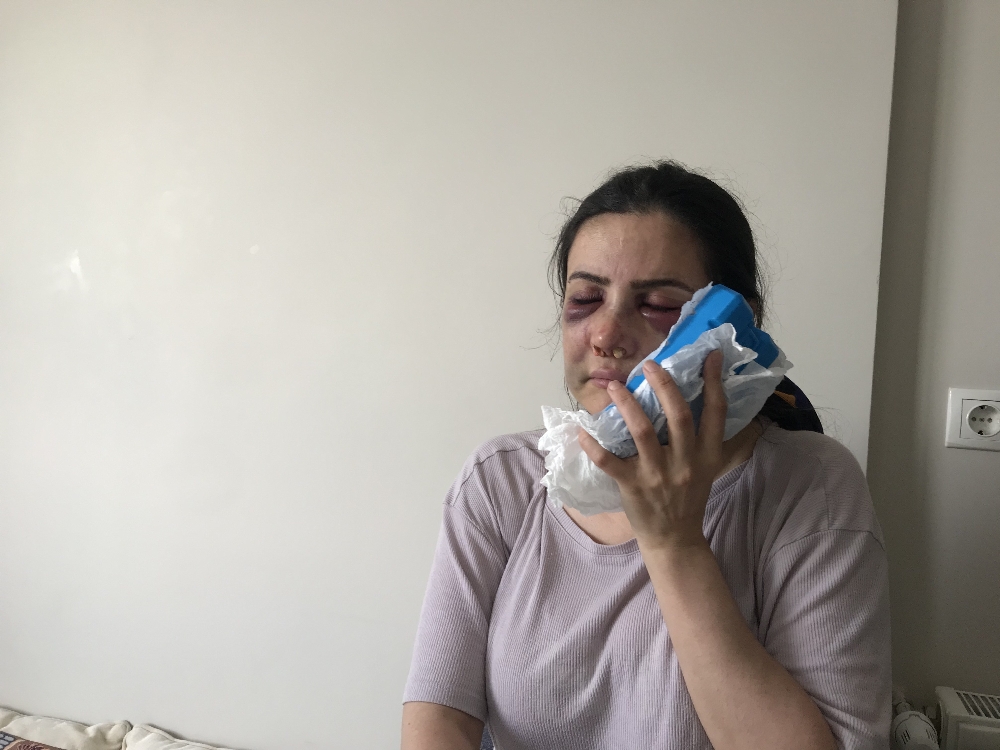 Kartal’da dehşeti yaşayan 2 çocuk annesi: 