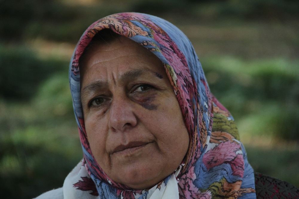 Komşu Tarafından Darp Edilen Kadın Gözyaşlarına Boğuldu