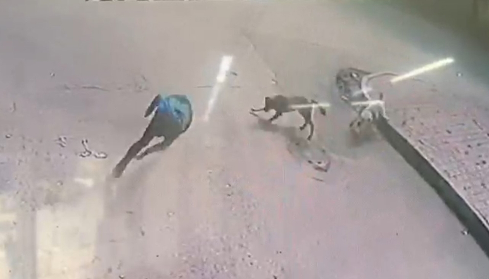 Köpekler bir anda saldırdı, genç ne yapacağını şaşırdı