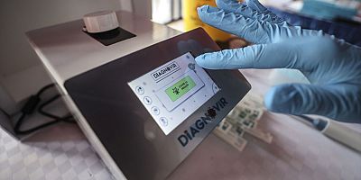 Korona teşhisini 10 saniyeye düşüren yerli test kullanımda