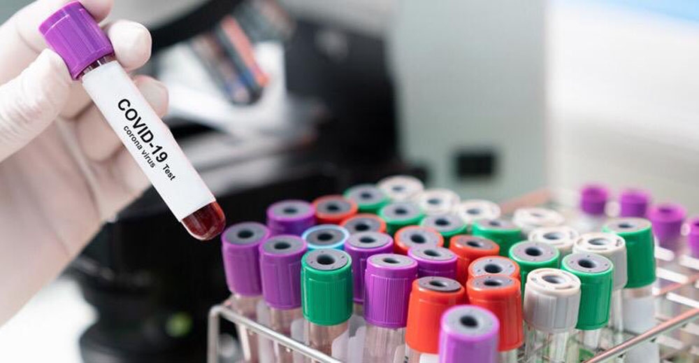 Koronavirüs dünya genelinde hız kesmiyor