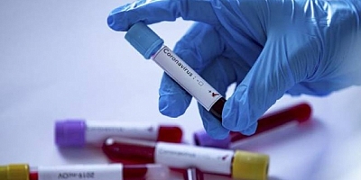 Koronavirüs hakkında çıkan haber sayısı 21 milyonu aştı