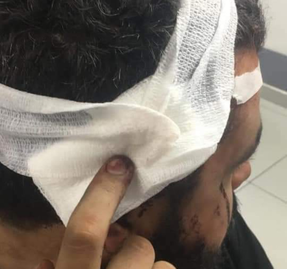Lübnan’da şiddetlenen protestolarda 220 yaralı