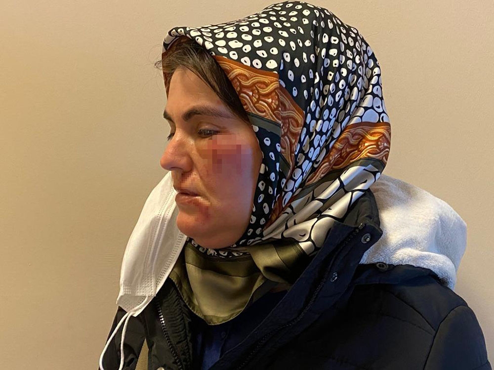Maltepe’de korkunç olay: Sokak ortasında tanımadığı şahsın saldırısına uğradı