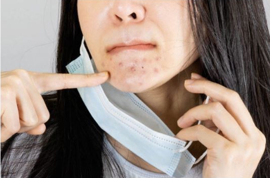 ‘Maske’ ile başa çıkmanın 2 yolu