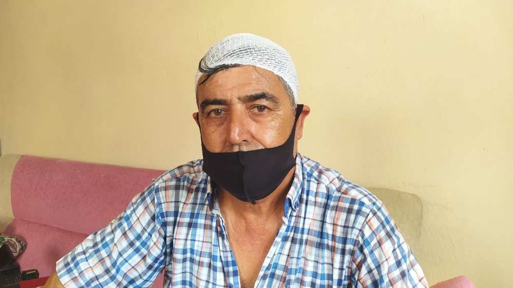 Maskesiz yolcu almayınca darp edilen şoförün başına 8 dikiş atıldı