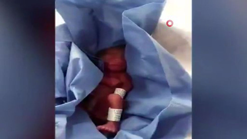 Meksika’da öldü denilerek morga kaldırılan bebeğin yaşadığı ortaya çıktı