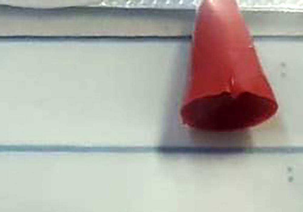 Mertin Ölümüne Neden Olan O Parça Otopsiyle Çıkarıldı