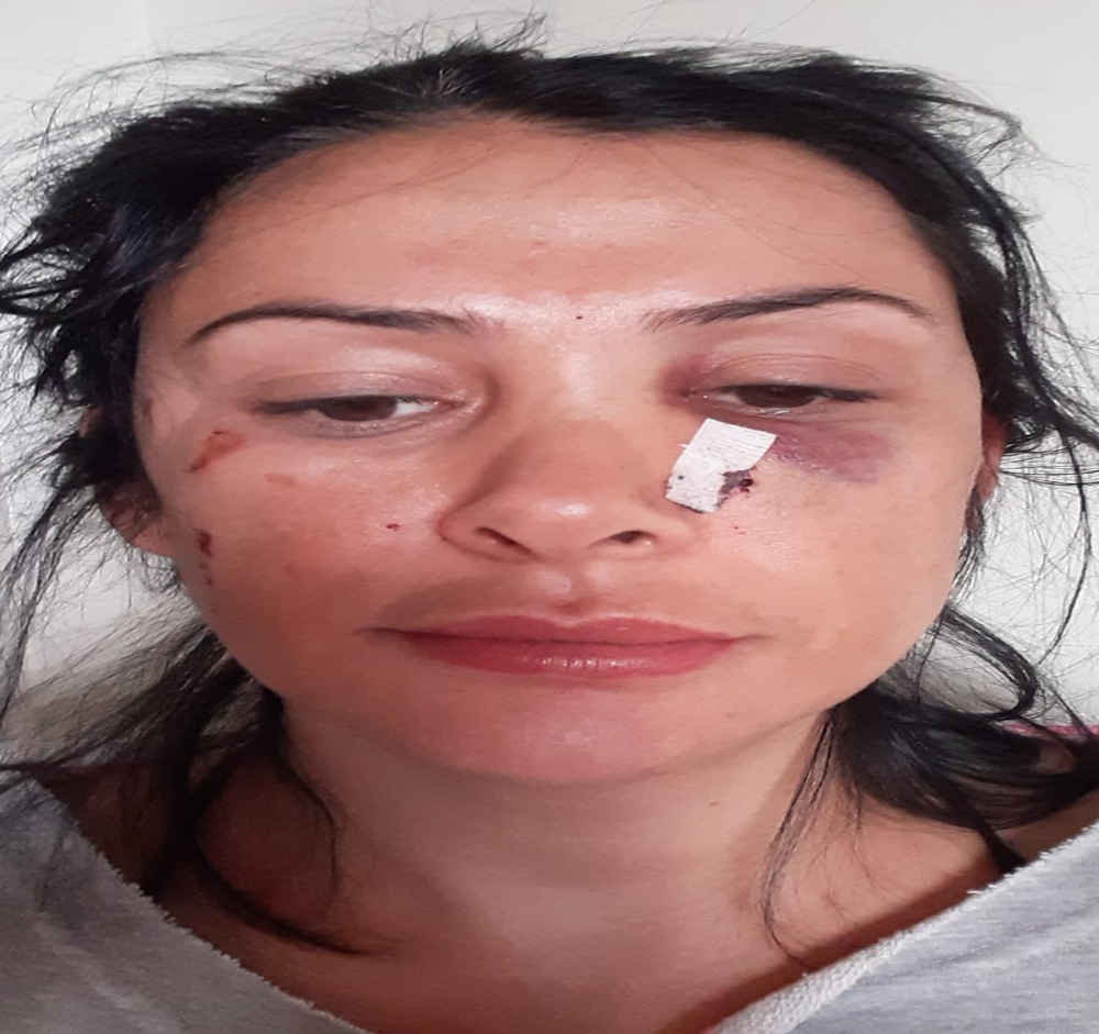 Öğretmenden komşusuna kalemli saldırı