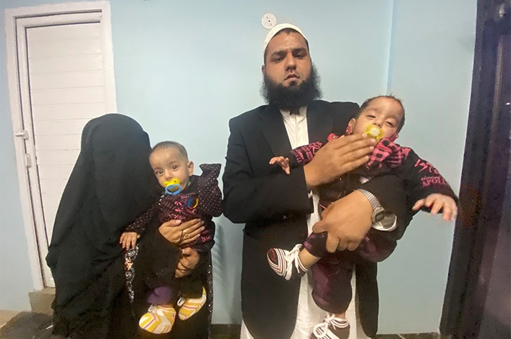Pakistan’da 9 aylık yapışık ikizler ameliyatla ayrıldı