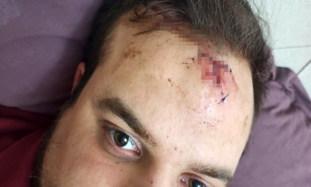 Pide siparişi mıntıka kavgasına dönüştü