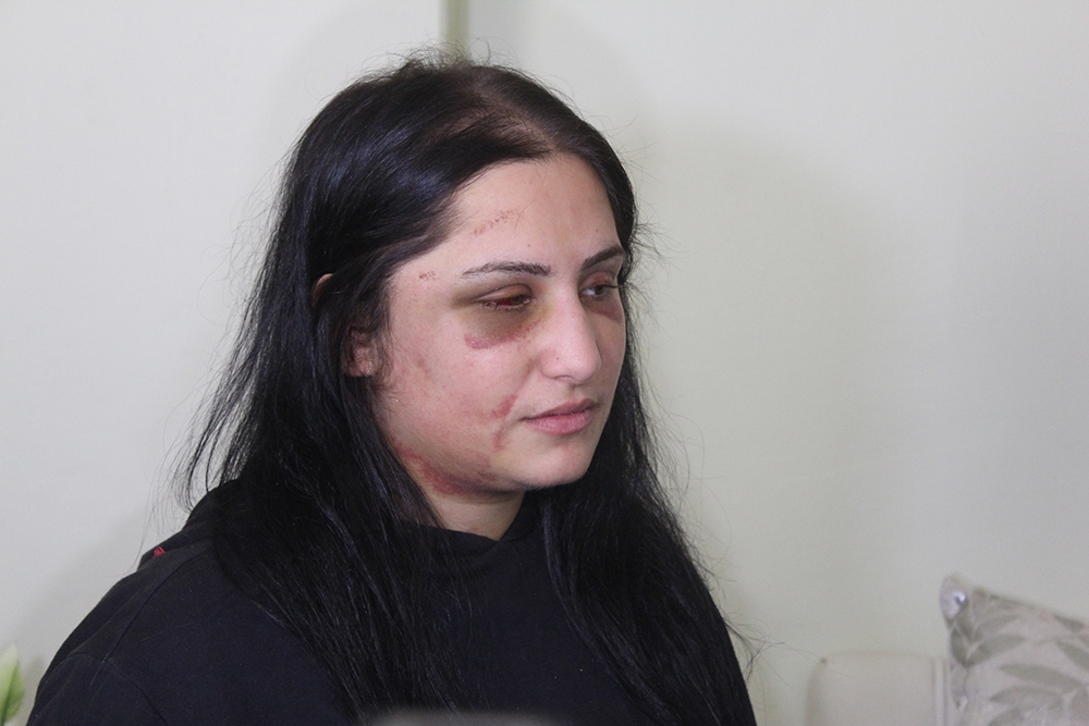 Samsun’daki kadına şiddet olayının iddianamesi kabul edildi