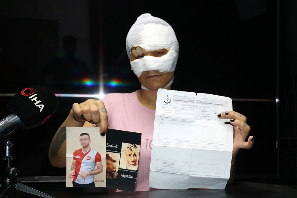 Sevgilisi tarafından öldüresiye işkence edildi