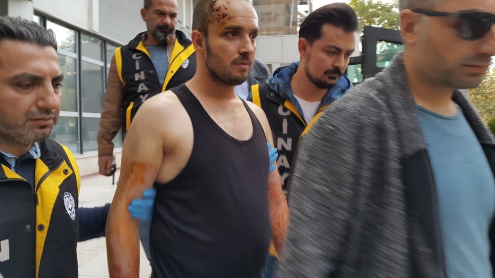 Sevgilisini Yakan Sanığa Müebbet