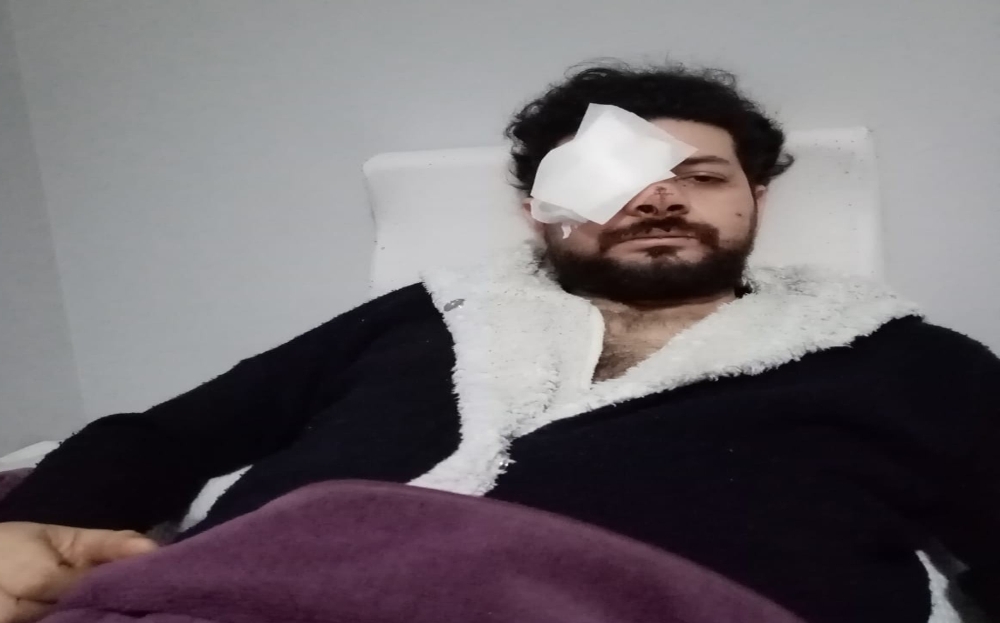 Şişli’de silahlı kavgada gözünü kaybeden genç şarkıcı dehşet anlarını anlattı