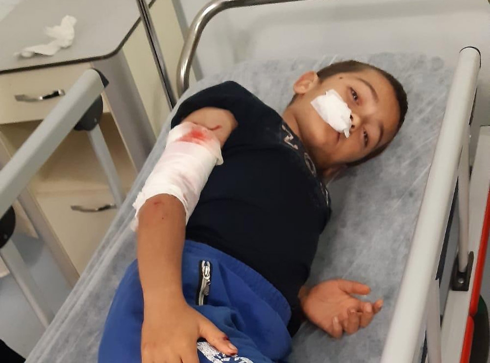Sultangazi’de 10 yaşındaki çocuğa köpek saldırdı