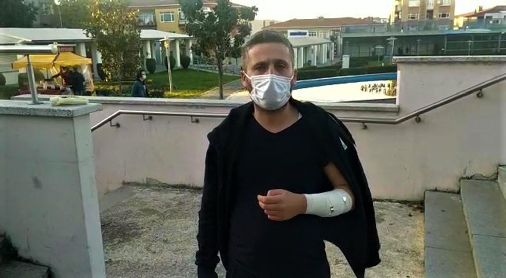 Tartıştığı halk otobüsü sürücüsüne copla saldırdı