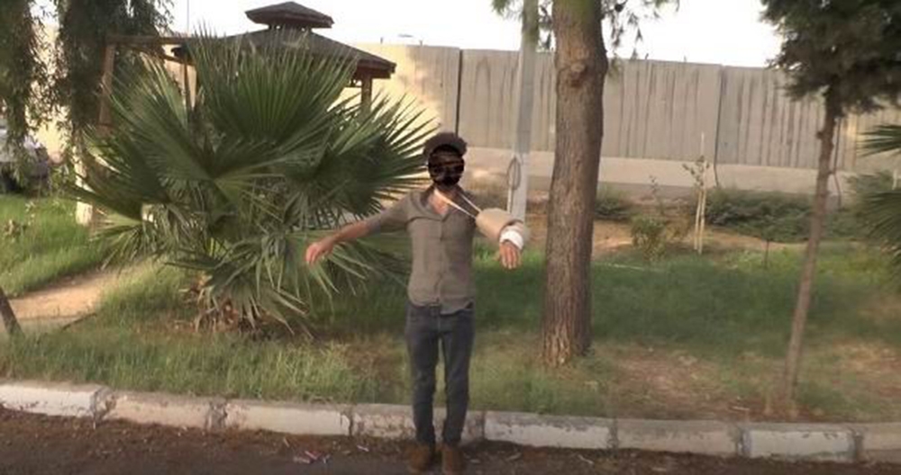 Terörist bombayı kolundaki alçıda kamufle etmiş