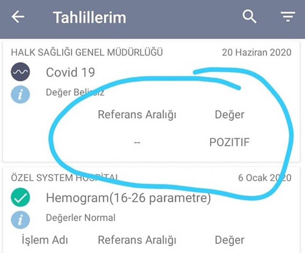 Testi pozitif çıktı sosyal medyadan uyardı