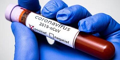 Türkiye koronanın ilacını buldu!.. Koronayı beş günde bitiriyor