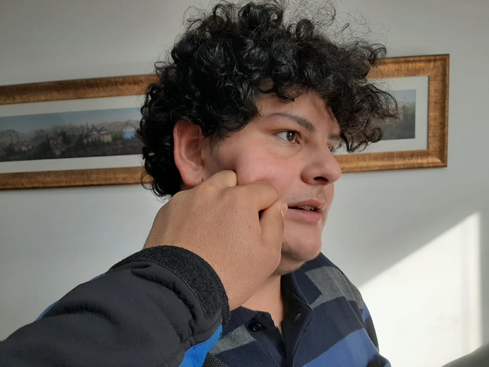 Yanaktan Makas Almak Tazminat Sebebi